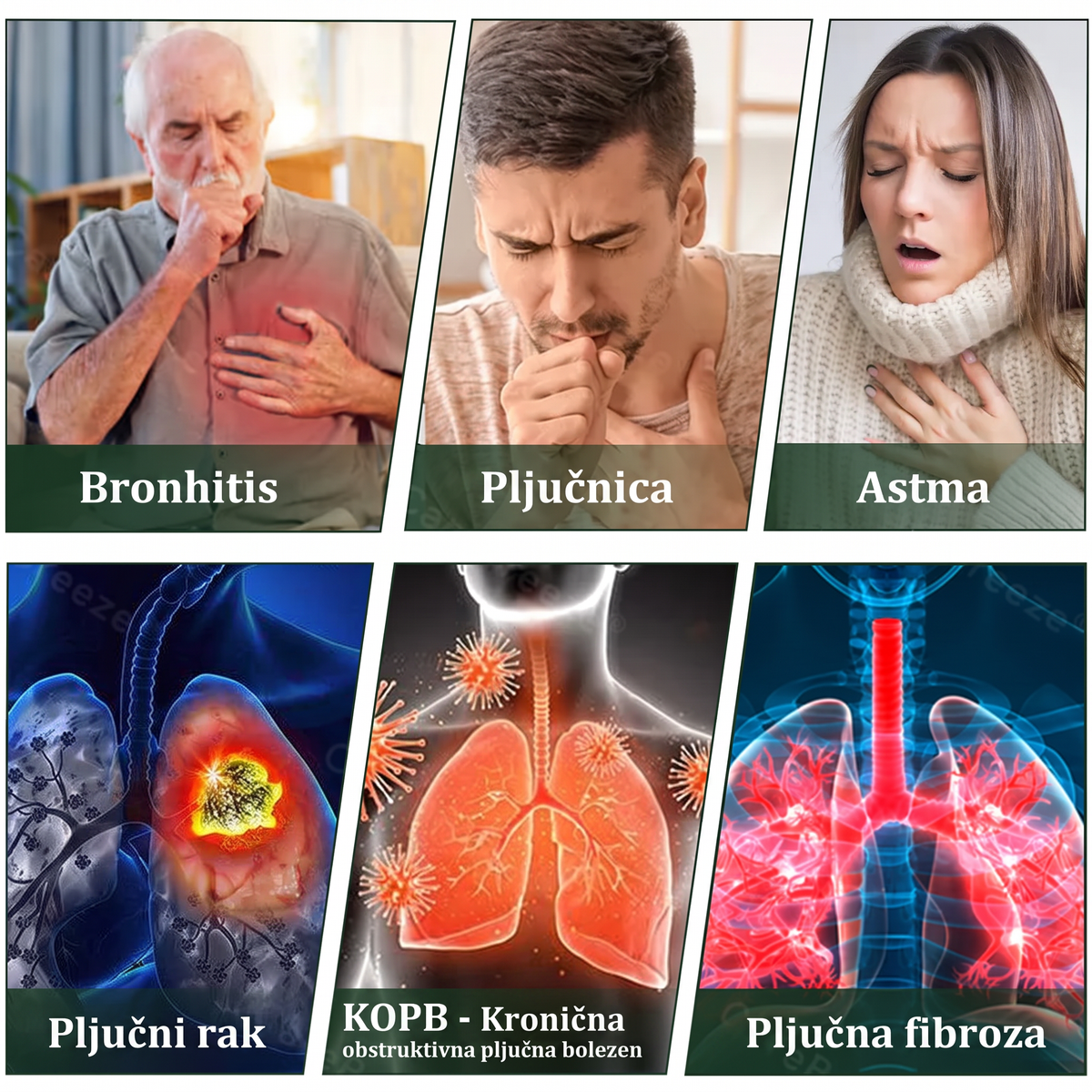 Vrhunski slovenski izdelek z domačo dostavo 🥇 Murwon® zeliščni parni inhalator za čiščenje pljuč 🍑 (👨‍⚕️ Učinkovita pomoč pri kašlju, vnetju grla, težkem dihanju, nastajanju sluzi, zamašenem nosu, bronhitisu, alergijskih simptomih in težavah s pljuči) ❤️