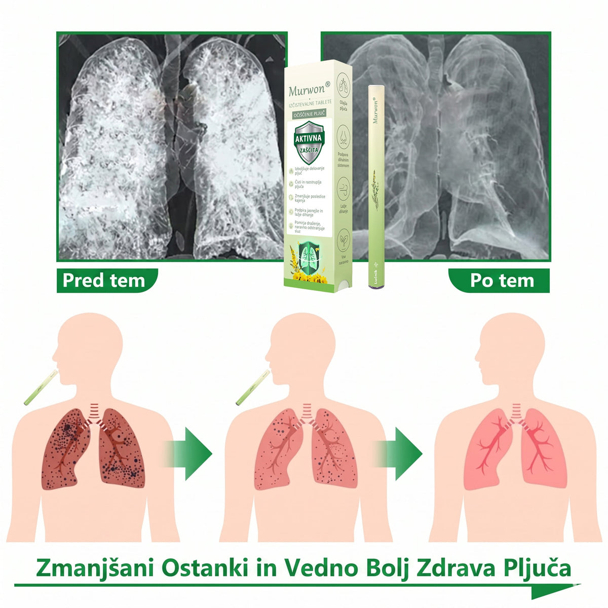 Vrhunski slovenski izdelek z domačo dostavo 🥇 Murwon® zeliščni parni inhalator za čiščenje pljuč 🍑 (👨‍⚕️ Učinkovita pomoč pri kašlju, vnetju grla, težkem dihanju, nastajanju sluzi, zamašenem nosu, bronhitisu, alergijskih simptomih in težavah s pljuči) ❤️